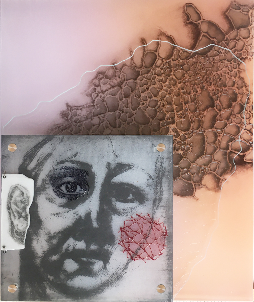 Self-portrait II (What chance do I have, with a  glass eye, a borrowed ear and a  scar on my face?)